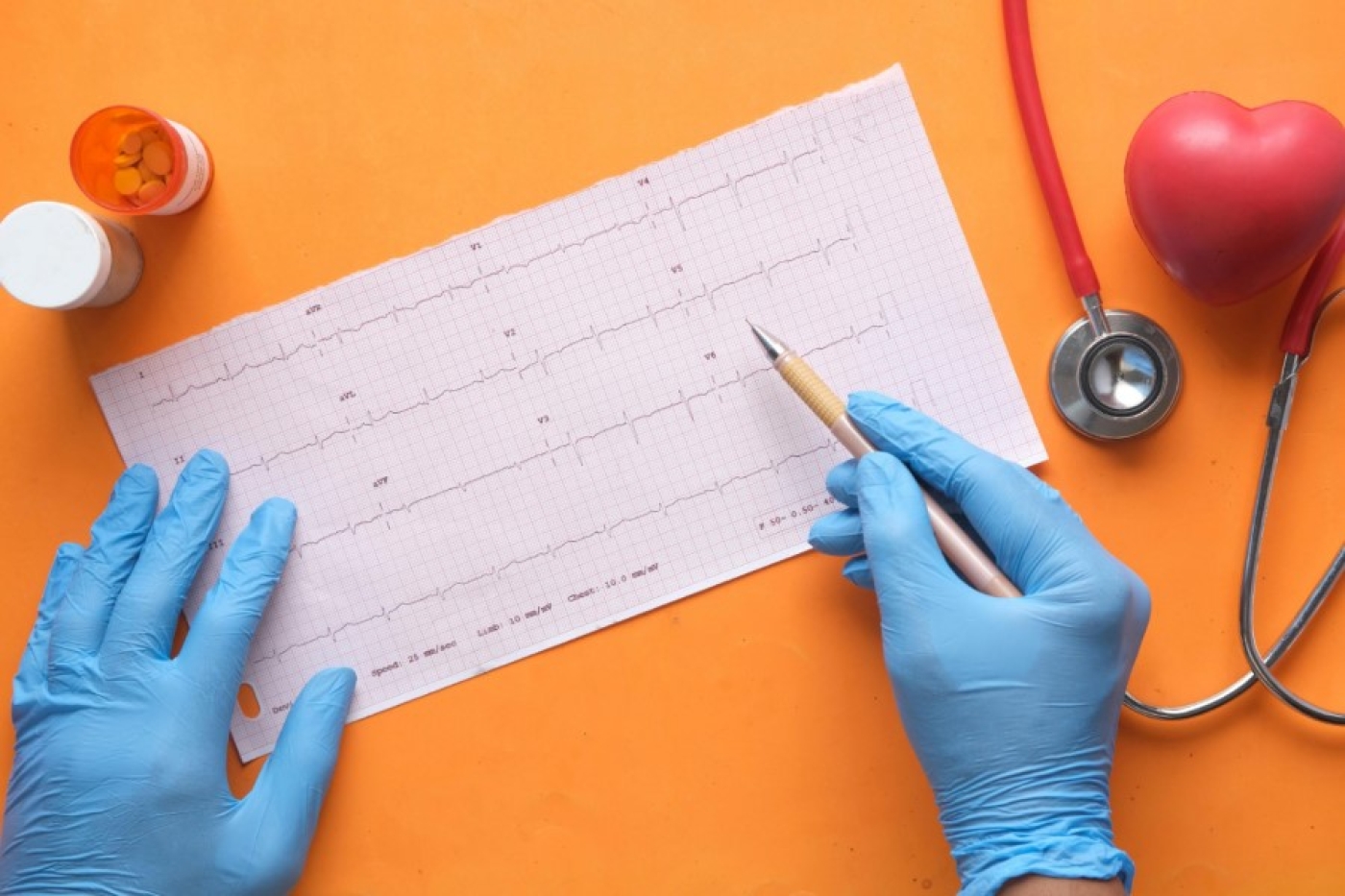 Кардиолог рассказала об ошибках, которые приводят к инфаркту