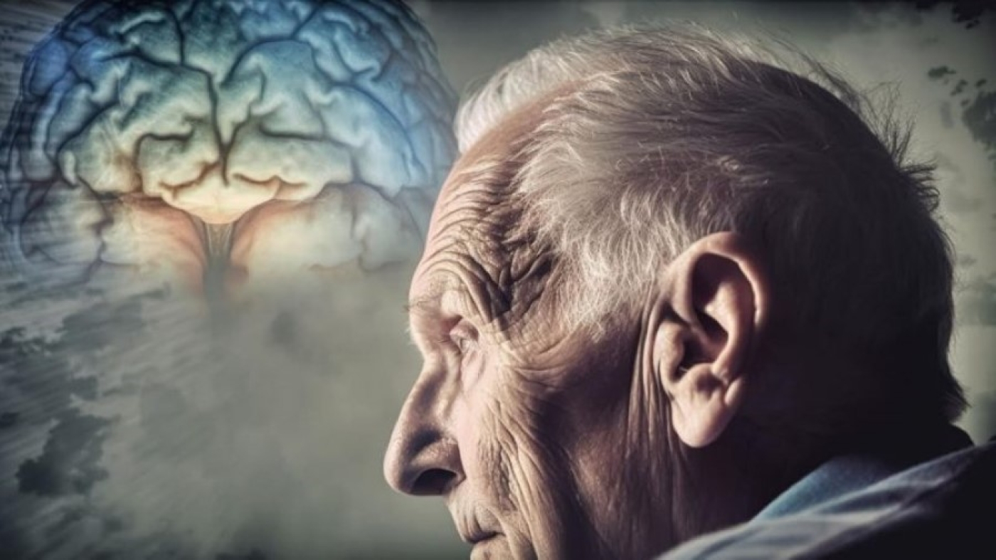 Деменция как причина смерти растет. Что понимают под здоровьем мозга?