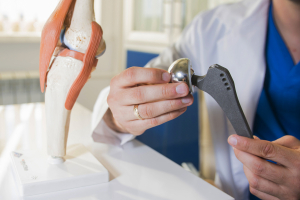 Эндопротезирование