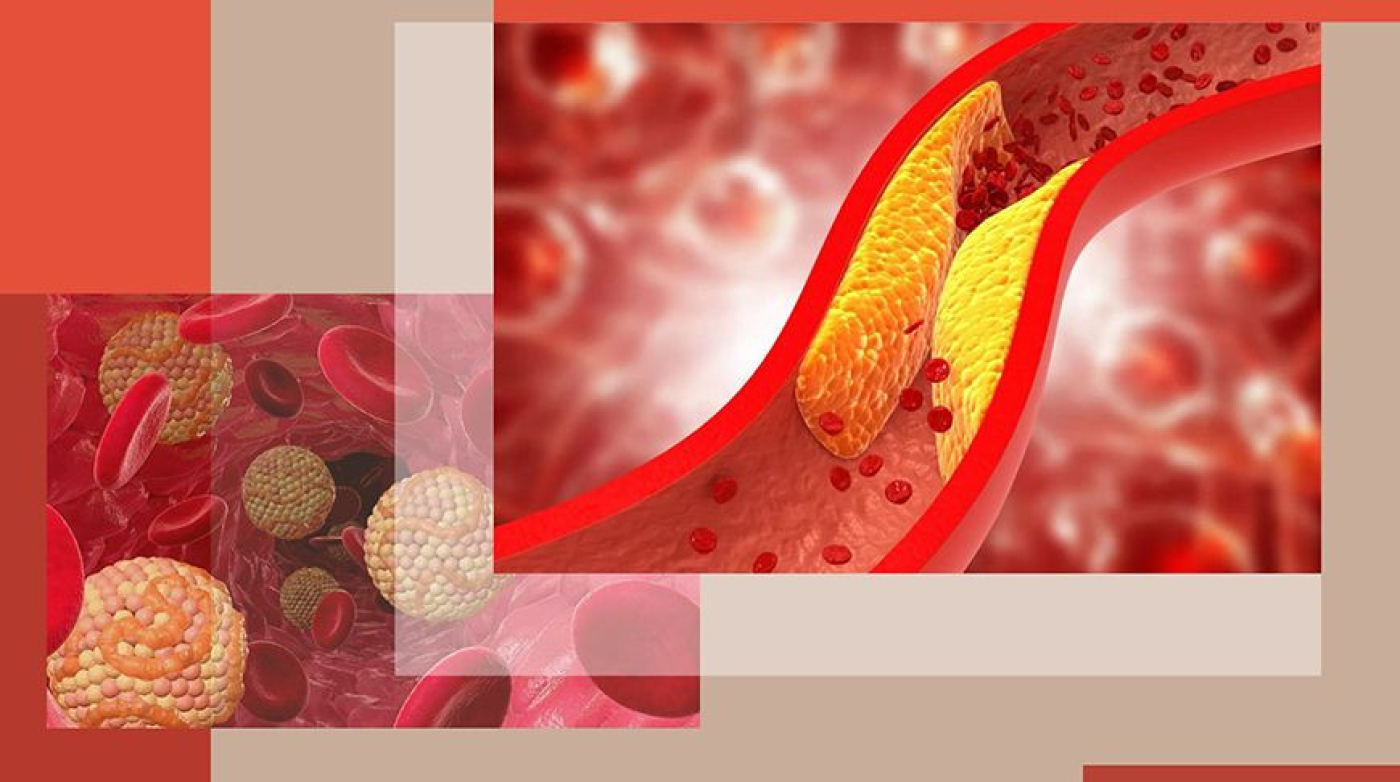 Холестерин: чем он опасен, когда сдавать анализ и как правильно питаться