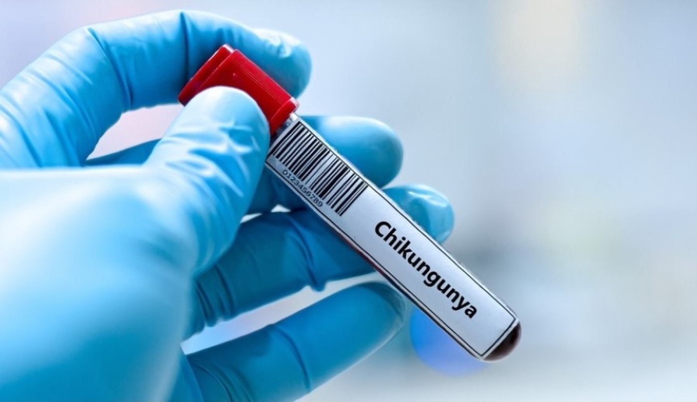 Второй завозной случай лихорадки чикунгунья зарегистрировали в России