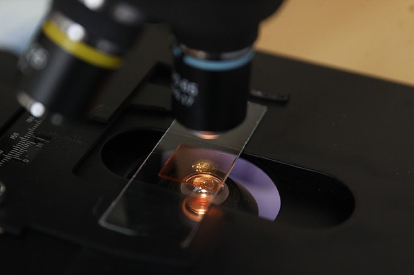 Стоит ли белорусам бояться вируса Нипах, разъяснили эпидемиологи