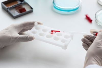 Можно ли есть и пить перед сдачей общего анализа крови — отвечает гематолог