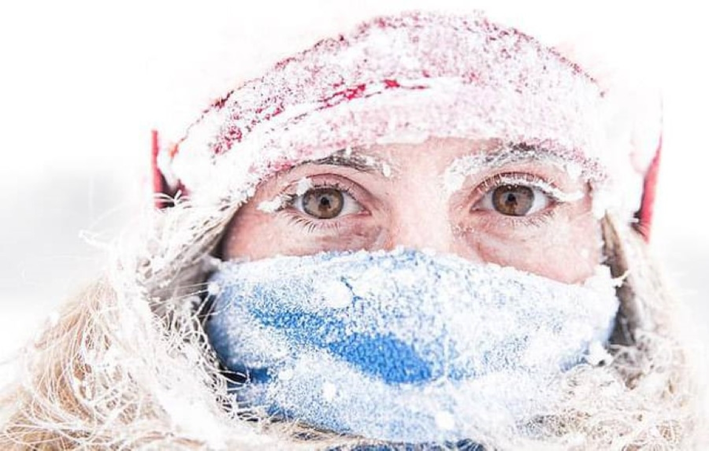 Обморожение и переохлаждение