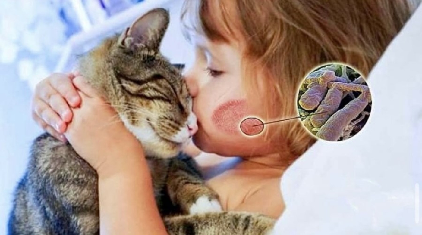 Микроспория: как защититься от стригущего лишая и уберечь здоровье