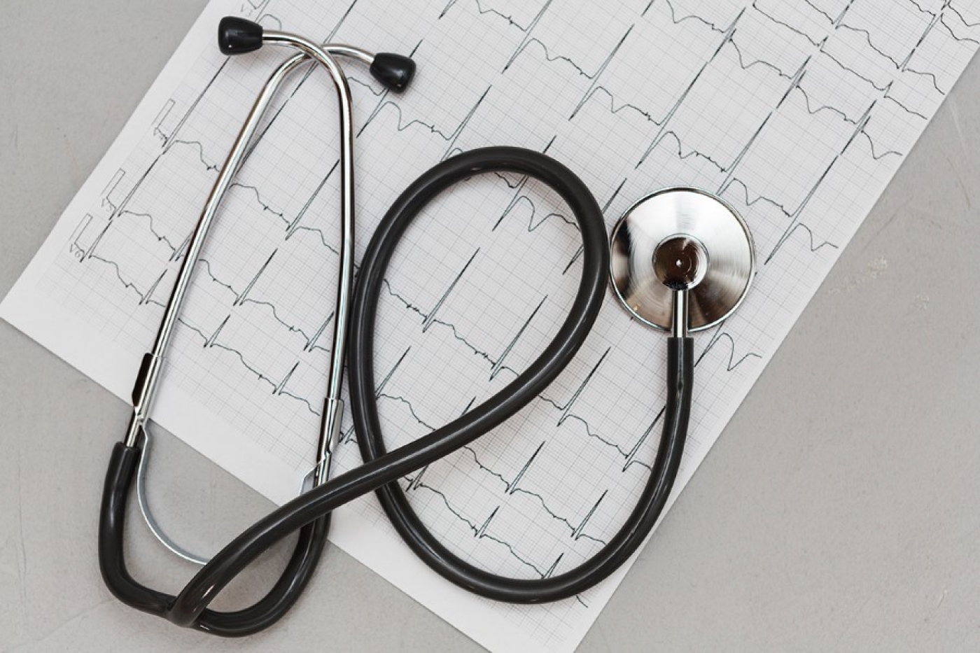 Можно ли вылечить аритмию? Отвечает кардиолог